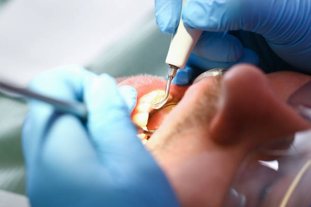 Best Emergency Dentist for Lost Fillings or Crowns in Vidalia, GA