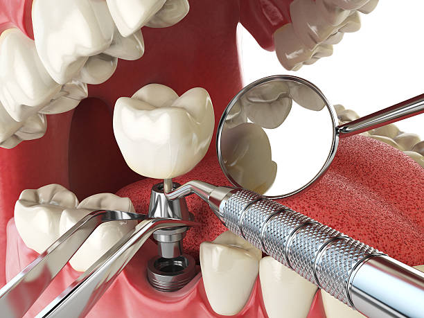 Best Pediatric Emergency Dentist in Vidalia, GA